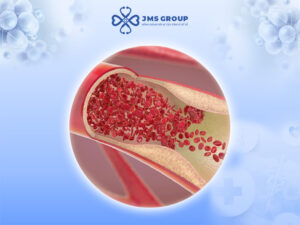Liệu pháp lọc máu Nhật Bản - JMS Group